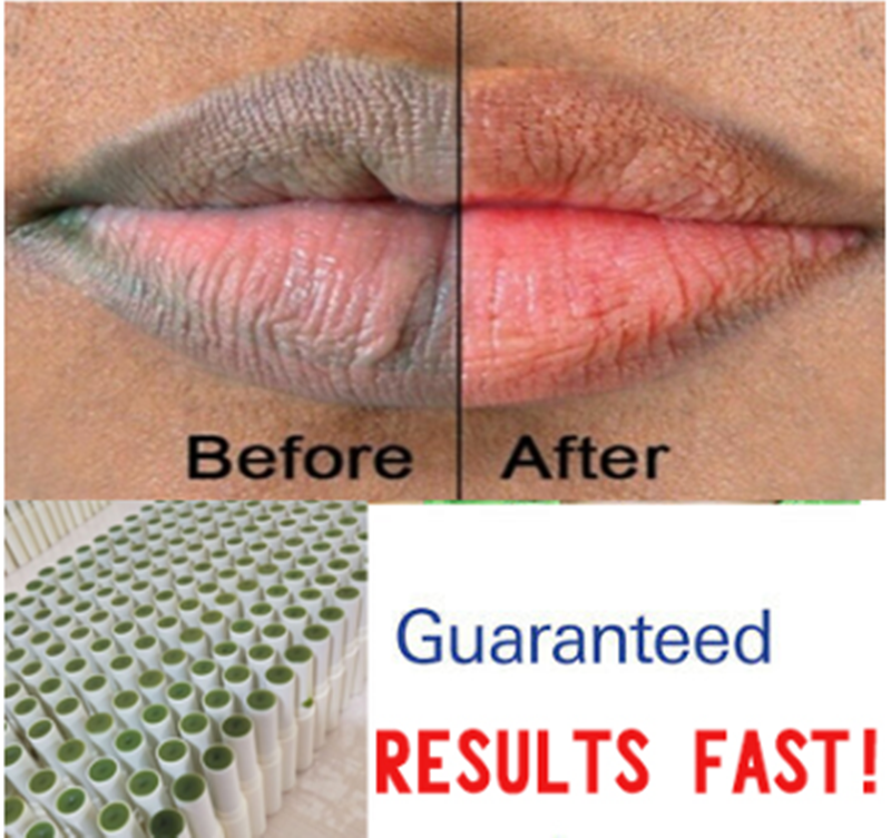 Green Juice Ve Lip Balm Plant Balm Nourish (3)